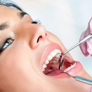 Ankyloglossia (Tongue Tie)